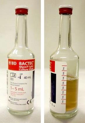 Bactec Myco/F Lytic bottle