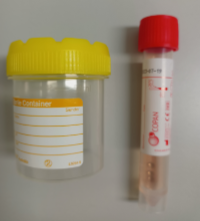 Chlamydia and Gonorrhoea PCR kit