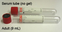 Plain tube- serum (No Gel)